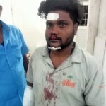 ರೈತನ ಮೇಲೆ ದಾಳಿ ನಡೆಸಿ ಗಾಯಗೊಳಿಸಿದ ಚಿರತೆ, ಚಿಕಿತ್ಸೆಗೆ ನೆರವಾದ ತಹಸೀಲ್ದಾರ್ ಡಾ. ಎಸ್.ಯು.ಅಶೋಕ್.